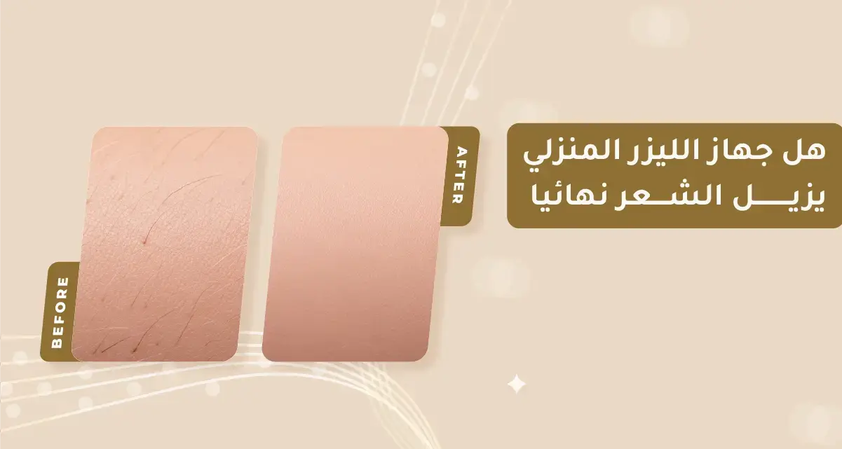 هل جهاز الليزر المنزلي يزيل الشعر نهائياً