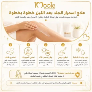 اسمرار البشرة بعد الليزر