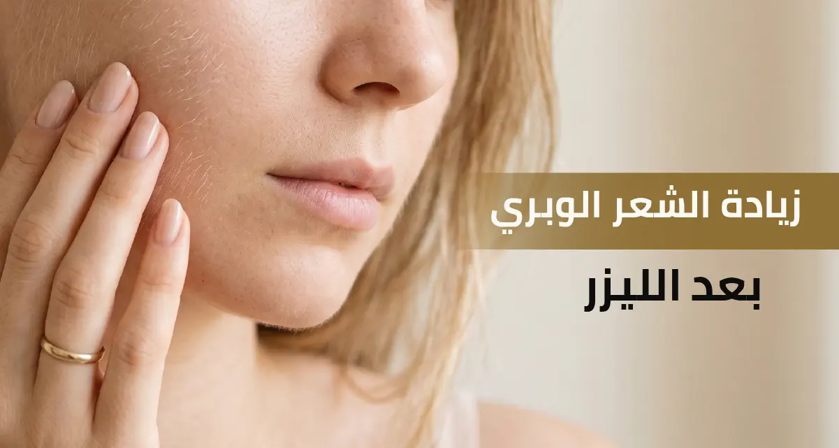 زيادة الشعر الوبري بعد الليزر