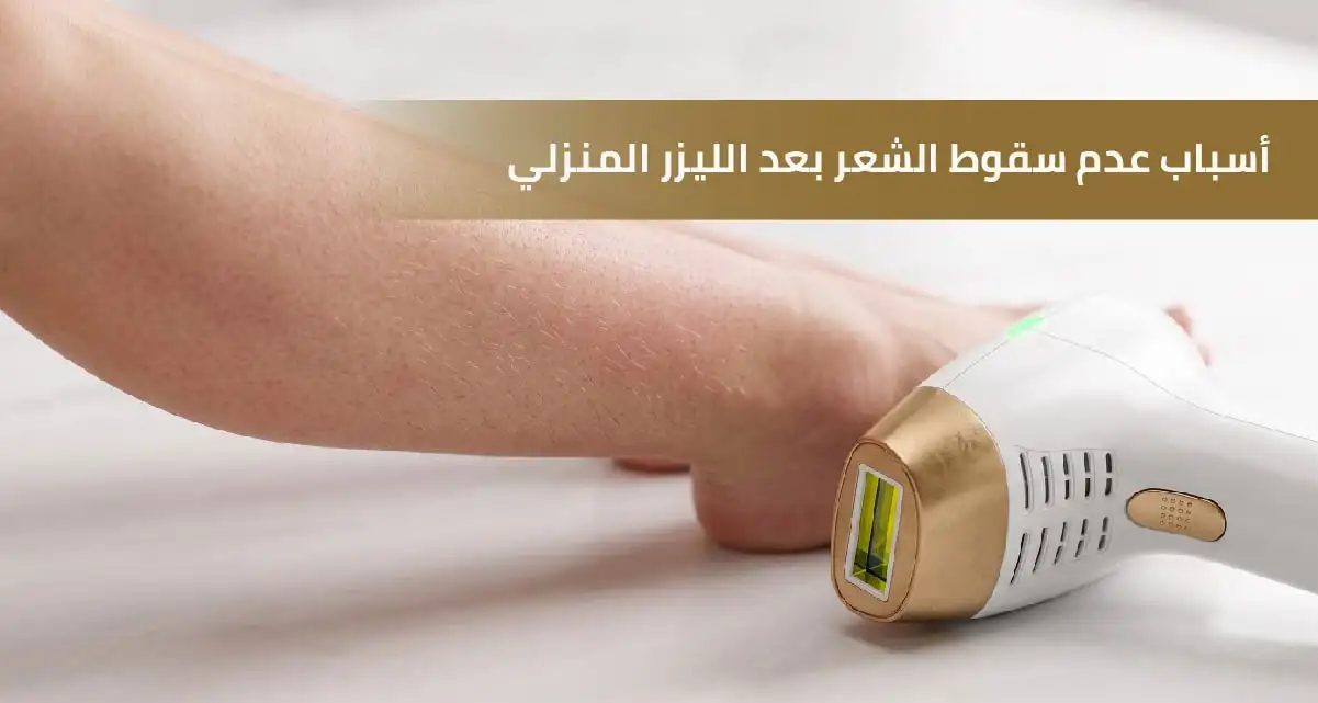 أسباب عدم سقوط الشعر بعد الليزر المنزلي